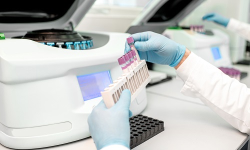 Putting Test Tubes Into The Holder Of Analyzer Machine